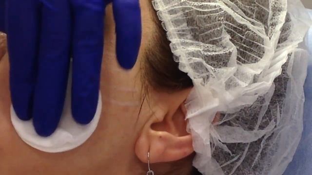 АирисКом обучение косметологии Спб. Мастер класс - биоармирование смотреть онлайн