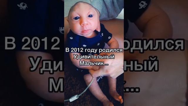 Мальчик который родился без мозга😱❌