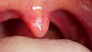 How Uvula Works? | Functions of uvula (Urdu/Hindi)