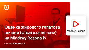 Жировой гепатоз печени (стеатоз печени). Оценка на Mindray Resona i9