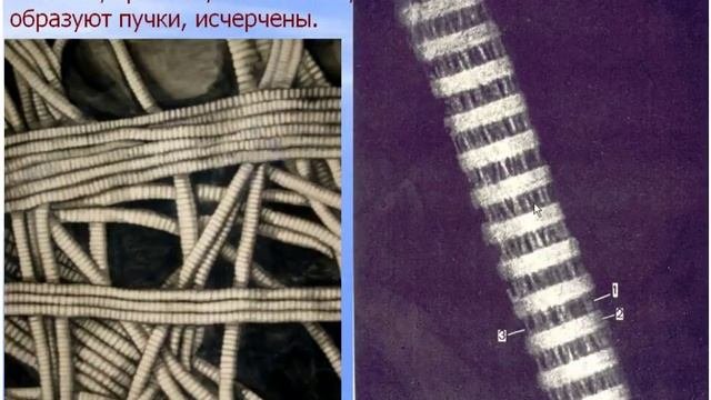 соединительная ткань