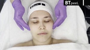 Процедура Зеленый пилинг биоревитализант с пептидами BTpeeL