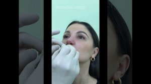 КАК ВЫРОВНЯТЬ НОЗДРИ ?