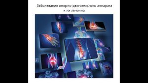 Заболевания опорно-двигательного аппарата (начало)