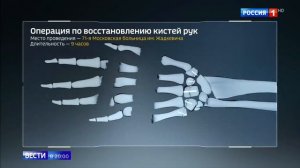 Муж отрубил жене руки