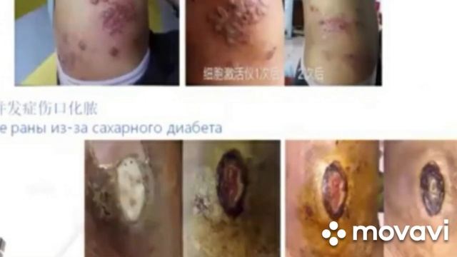 Aктиватор клеток с результатами применения