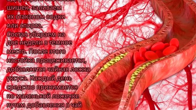 5 Самых эффективных способов для Чистки сосудов