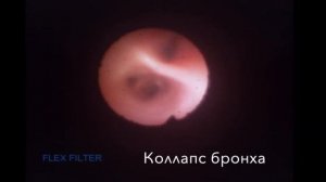 Ларингоскопия и трахеобронхоскопия у собаки