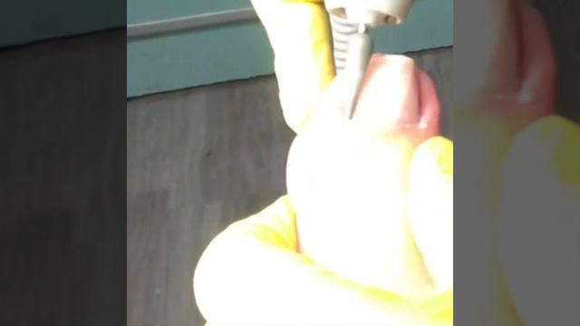 Обработка проблемных ногтей смотреть онлайн