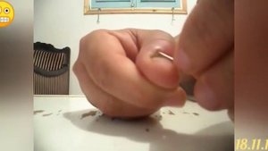 ПРЫЩИ на пальцах рук