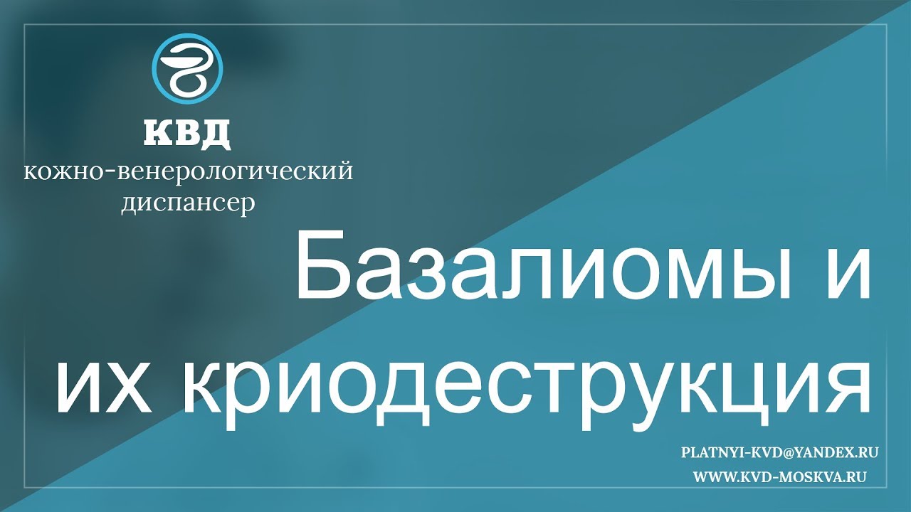 86  Базалиомы и их криодеструкция