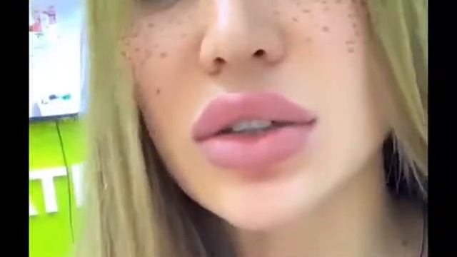 Ортодонтическое лечение Елизаветы Полыгаловой