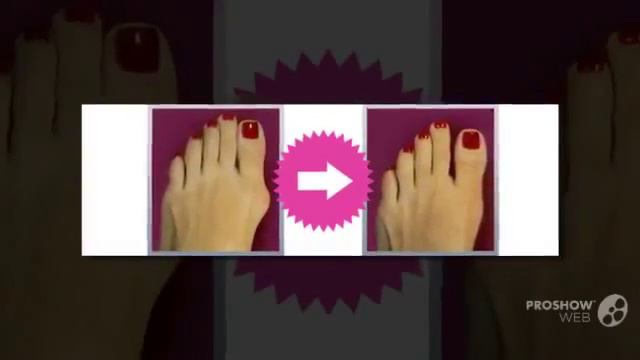 Фиксатор корректор большого пальца смотреть онлайн