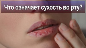 Стоит ли обращаться к врачу из за сухости во рту? | Что  сухость во рту означает?