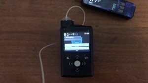 Один день с инсулиновой помпой Medtronic 670g, мои впечатления