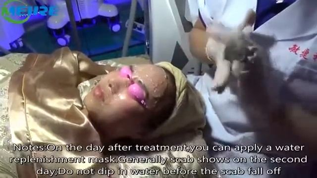 Мультифункциональный аппарат 4 в 1 Nd-yag IPL OPT SHR RF. Лазер для удаления татуажа, удаления воло смотреть онлайн