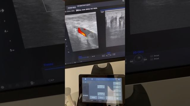 Осмотр флеболога. Варикоз. Тромбоз. Лечение сосудов. Флеболог Москва. Флеболог смотреть онлайн