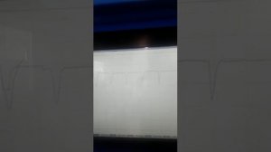 Ремонт гидроблока АКПП Хендай Санта фе 2,2 дизель 2011 г.