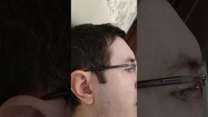 Вертексное расстояние