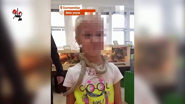 Змея вцепилась девочке в лицо. смотреть онлайн
