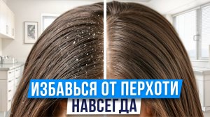 НЕ ПУТАЙТЕ перхоть с БОЛЕЗНЬЮ! / Как выглядит себорейный дерматит?