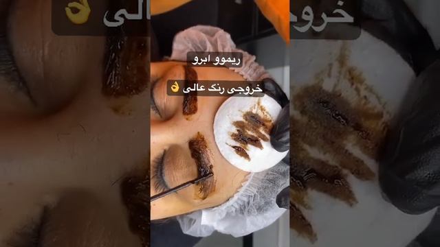پاک کردن تاتوی قدیمی ?♀️ خروجی رنگ عالی ? #removal #eyebrow #microblading смотреть онлайн