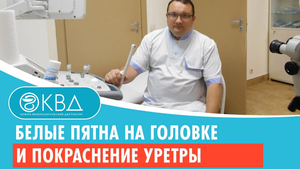 ? Белые пятна на головке и покраснение уретры. Клинический случай №409