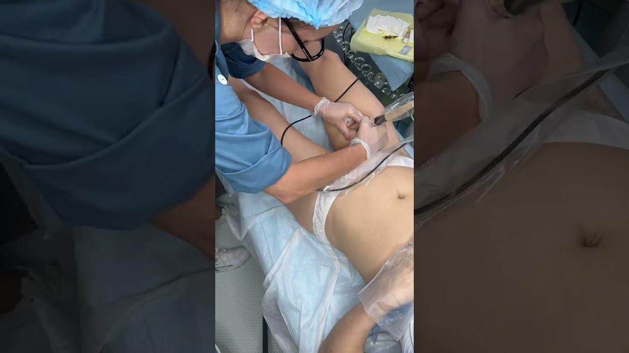 ВИТИЛИГО В ИНТИМНОЙ ЗОНЕ ЗАКРАСИЛИ НА ДОЛГИЕ ГОДЫ  ЧТОБЫ НЕ СТЕСНЯТЬСЯ И БОЯТЬСЯ РАЗДЕТЬСЯ #shorts