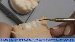 Базовый курс по изготовлению акриловых протезов, с опорой на обработанные зубы и имплантаты.