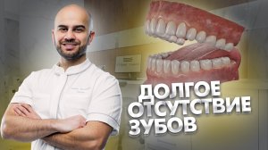 К чему приводит длительное отсутствие зубов?