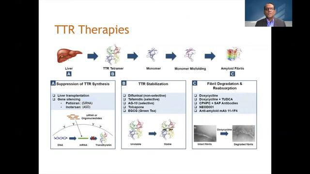 Session 1 - Pulmonary Embolism and Cardiac Amyloidosis/Sarcoidosis смотреть онлайн
