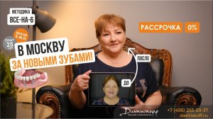 В МОСКВУ за зубами✨+7 (495) 255-59-37 Екатерина. 62 года. Видеоотзыв от пациентки Дантистофф