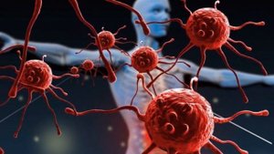 Мочевая кислота, Подагра, Камни в Почках! 6 продуктов для Растворения Кристаллов Мочевой Кислоты