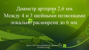 Аневризма позвоночной артерии