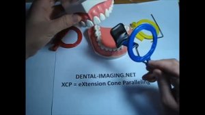 Как использовать держатель снимков для Передних зубов (синий) Периферийный рентген