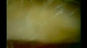 Соединительная ткань.