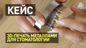 Бюгели, мосты, коронки из кобальт-хрома, титана - 3D-печать металлами в стоматологии - Top 3D Group