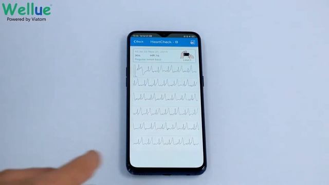 Przenośny monitor EKG Pulsebit EX /Checkme Plus смотреть онлайн
