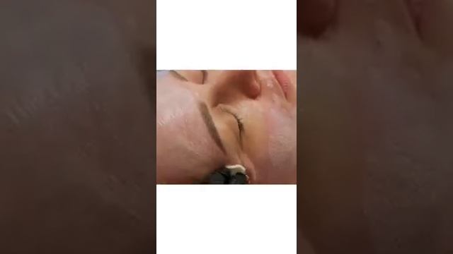 АирисКом студенты учатся: семинар по обучению применения ТСА пилинга 25% при коррекции кожи. смотреть онлайн