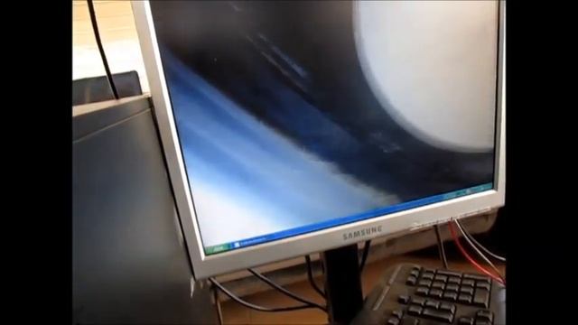 Эндоскопия ДВС JProbe NT jProbe ST смотреть онлайн