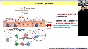 Школа клинического мышления педиатра. Целиакия у ребенка - как не пропустить диагноз?