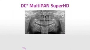 MyRay HYPERION X9 PRO - Image enhancer with DCIII (Direct Conversion) technology [EN]