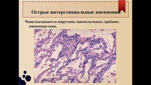 Слесарева Е.В. Пат анатомия Болезни органов дыхания 15.12.2021