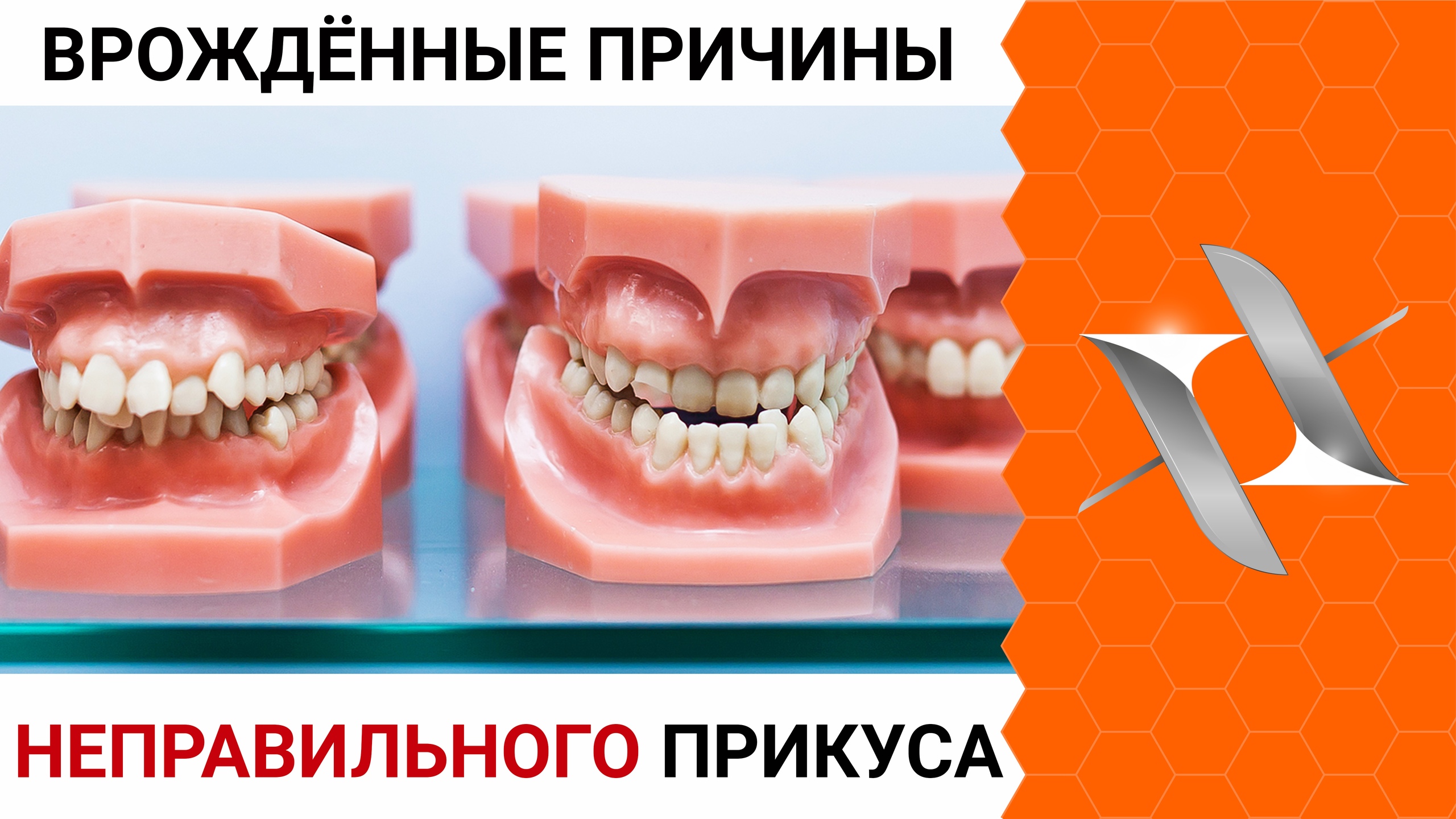НЕПРАВИЛЬНЫЙ ПРИКУС - Врождённые причины ортодонтических аномалий.