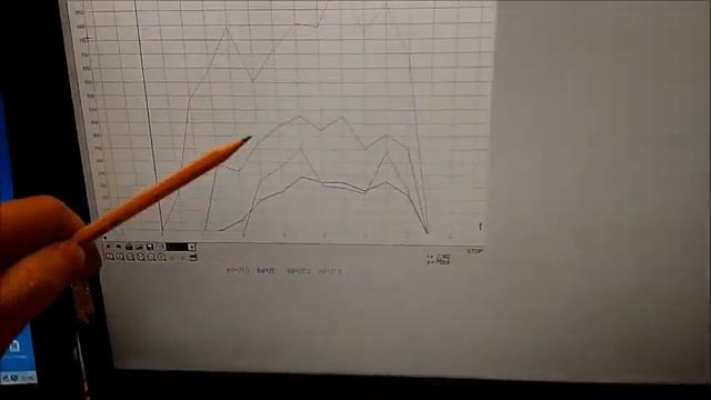 Dynamometer for Post Stroke Rehabilitation 2017HackadyPrize смотреть онлайн