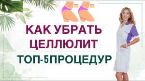 КАК УБРАТЬ ЦЕЛЛЮЛИТ❓КАК ПОХУДЕТЬ? РАЗБОР ЛУЧШИХ ПРОЦЕДУР Врач эндокринолог, диетолог Ольга Павлова