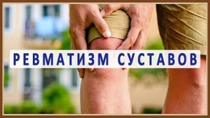 РЕВМАТИЗМ СУСТАВОВ - ПРИЧИНЫ СИМПТОМЫ ЛЕЧЕНИЕ.mp4