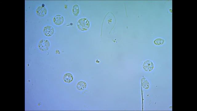 Хлорелла Chlorella vulgaris under microscope