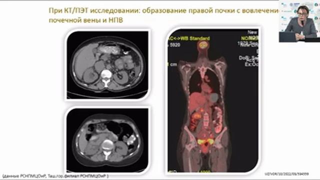Вебинар приуроченный ко Международному дню уролога 2022 г. смотреть онлайн