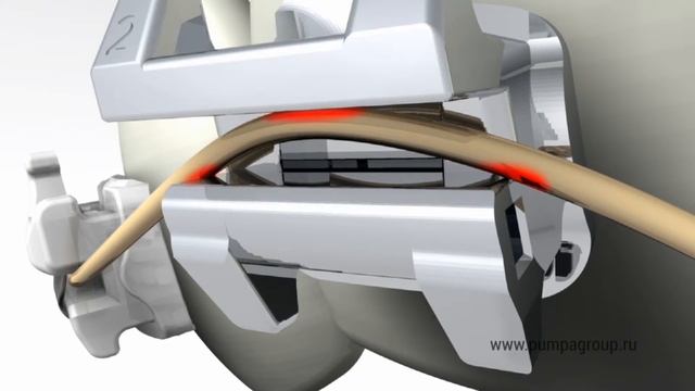 QuicKlear — паз брекета смотреть онлайн